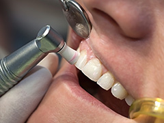 当院の予防歯科は自費診療です。